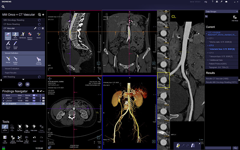 nspka CT vascular